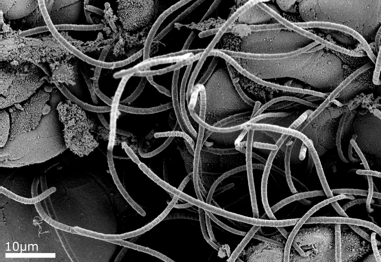 Commensal bacteria attached to epithelial cells of small mouse intestine. Samples were prepared by chemical fixation before being imaged at room temperature with the InLens detector.